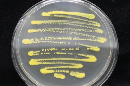 Yellow bacteria streaked on an agar plate.