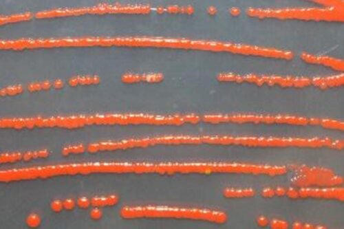 Detail of orange bacteria streaked on an agar plate.